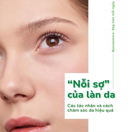 “NỖI SỢ” CỦA LÀN DA MÀ BẠN CẦN BIẾT